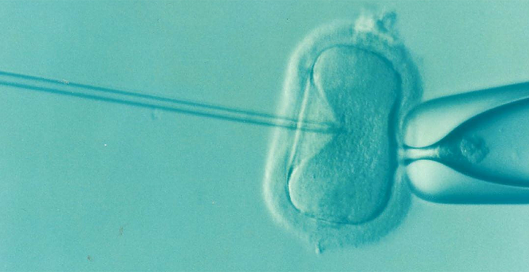 image of in vitro fertilisation